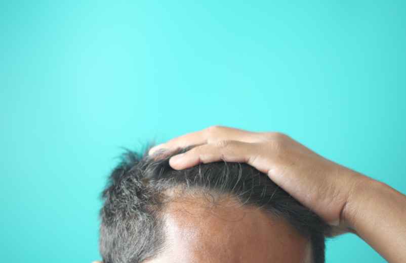 Comment gérer alors ses premiers cheveux blancs ?-Luxury Design Comment gérer alors ses premiers cheveux blancs ?-Luxury Design
